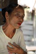�ena z etnika Chin, okol� Mrauk U. �eny maj� tradi�n� tetovan� obli�eje. Myanmar (Barma).